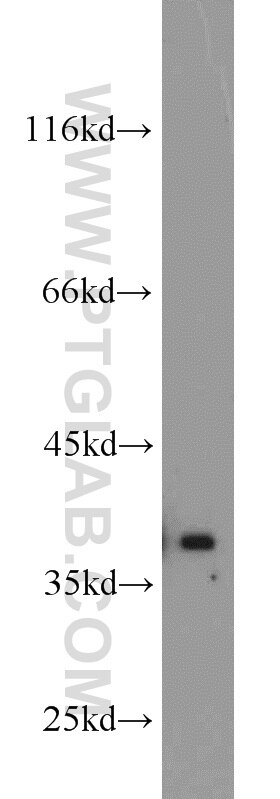 MCF7 cells were subjected to SDS PAGE followed by western blot with PCNA Antibody 10205-2-AP PCNA western blot WB 10205-2-AP PCNA Antibody MGC8367