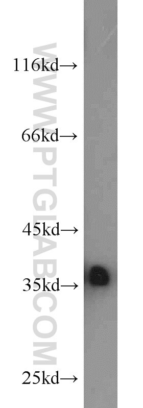 rat liver tissue were subjected to SDS PAGE followed by western blot with PCNA Antibody 10205-2-AP PCNA western blot WB 10205-2-AP PCNA Antibody MGC8367