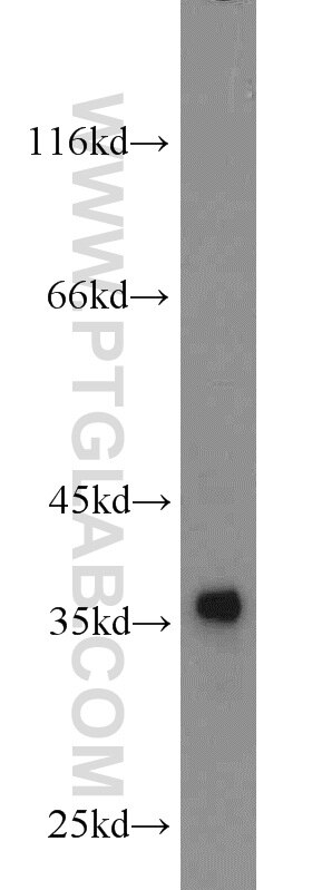rat liver tissue were subjected to SDS PAGE followed by western blot with PCNA Antibody 10205-2-AP PCNA western blot WB 10205-2-AP PCNA Antibody MGC8367