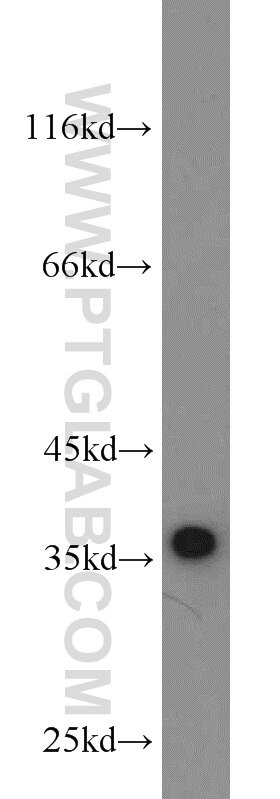 rat liver tissue were subjected to SDS PAGE followed by western blot with PCNA Antibody 10205-2-AP PCNA western blot WB 10205-2-AP PCNA Antibody MGC8367