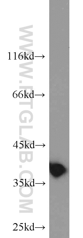 mouse liver tissue were subjected to SDS PAGE followed by western blot with PCNA Antibody 10205-2-AP PCNA western blot WB 10205-2-AP PCNA Antibody MGC8367