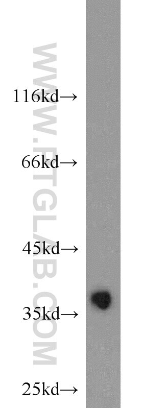 mouse liver tissue were subjected to SDS PAGE followed by western blot with PCNA Antibody 10205-2-AP PCNA western blot WB 10205-2-AP PCNA Antibody MGC8367