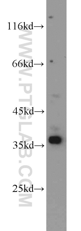 HEK-293 cells were subjected to SDS PAGE followed by western blot with PCNA Antibody 10205-2-AP PCNA western blot WB 10205-2-AP PCNA Antibody MGC8367