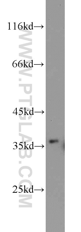 HEK-293 cells were subjected to SDS PAGE followed by western blot with PCNA Antibody 10205-2-AP PCNA western blot WB 10205-2-AP PCNA Antibody MGC8367
