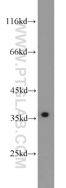 HEK-293 cells were subjected to SDS PAGE followed by western blot with PCNA Antibody 10205-2-AP PCNA western blot WB 10205-2-AP PCNA Antibody MGC8367