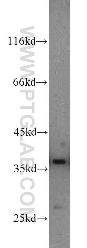NIH/3T3 cells were subjected to SDS PAGE followed by western blot with PCNA Antibody 10205-2-AP PCNA western blot WB 10205-2-AP PCNA Antibody MGC8367