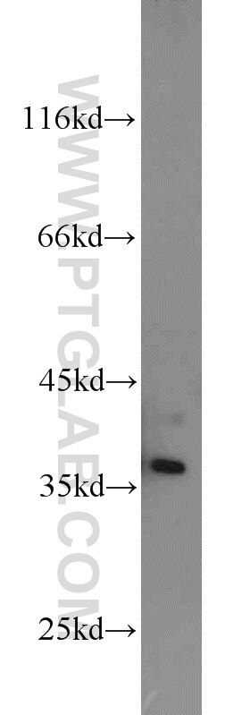 NIH/3T3 cells were subjected to SDS PAGE followed by western blot with PCNA Antibody 10205-2-AP PCNA western blot WB 10205-2-AP PCNA Antibody MGC8367