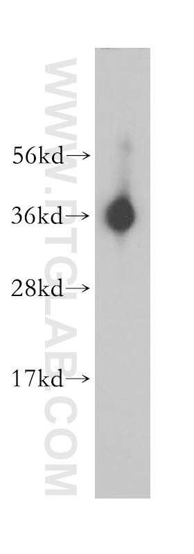MCF7 cells were subjected to SDS PAGE followed by western blot with PCNA Antibody 10205-2-AP PCNA western blot WB 10205-2-AP PCNA Antibody MGC8367