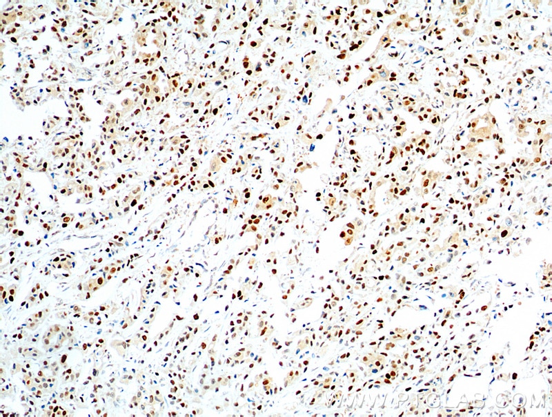 PCNA IHC Immunohistochemical 60097-1-Ig PCNA Antibody MGC8367