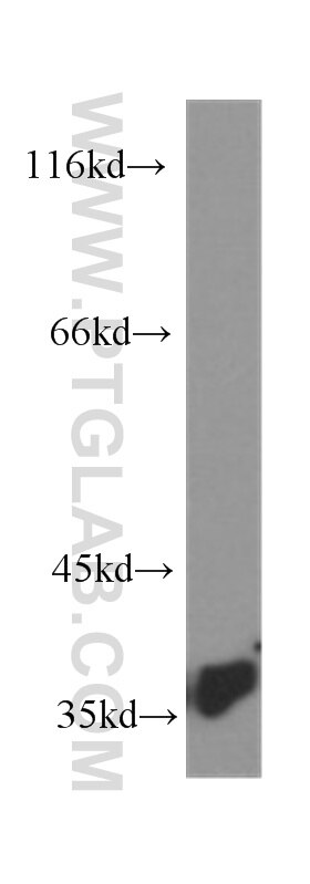 PCNA western blot WB 60097-1-Ig PCNA Antibody MGC8367