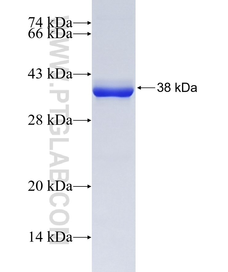 PCNA fusion protein ag7416 SDS-PAGE