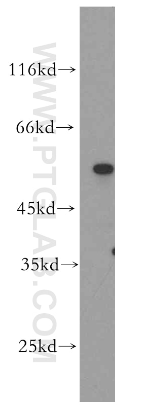 PCSK4 western blot WB 15106-1-AP PCSK4 Antibody DKFZp434B217; MGC34749; PC4; SPC5