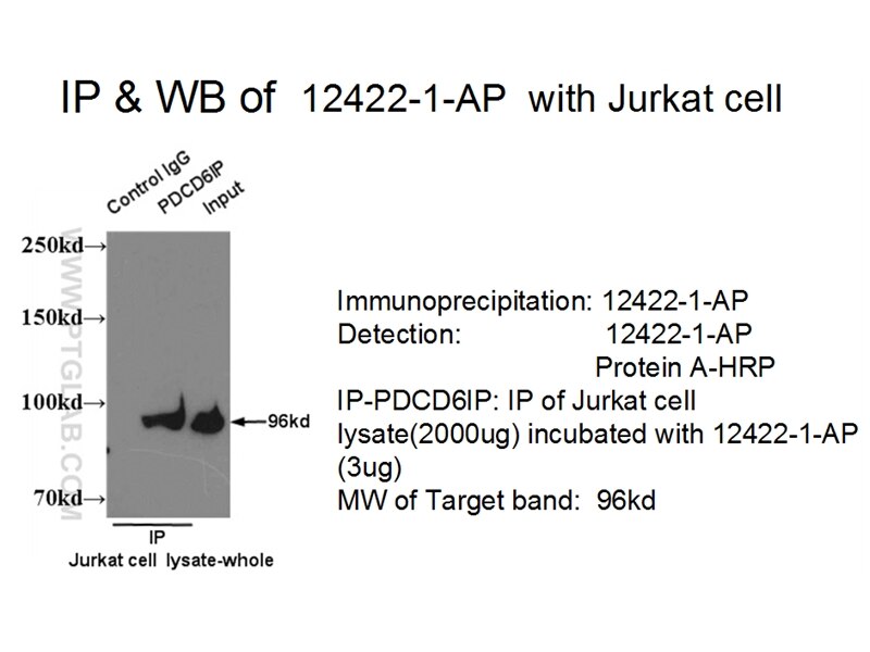 ALIX; AIP1 IP 12422-1-AP ALIX; AIP1 Antibody AIP1; Alix; DRIP4; HP95; MGC17003