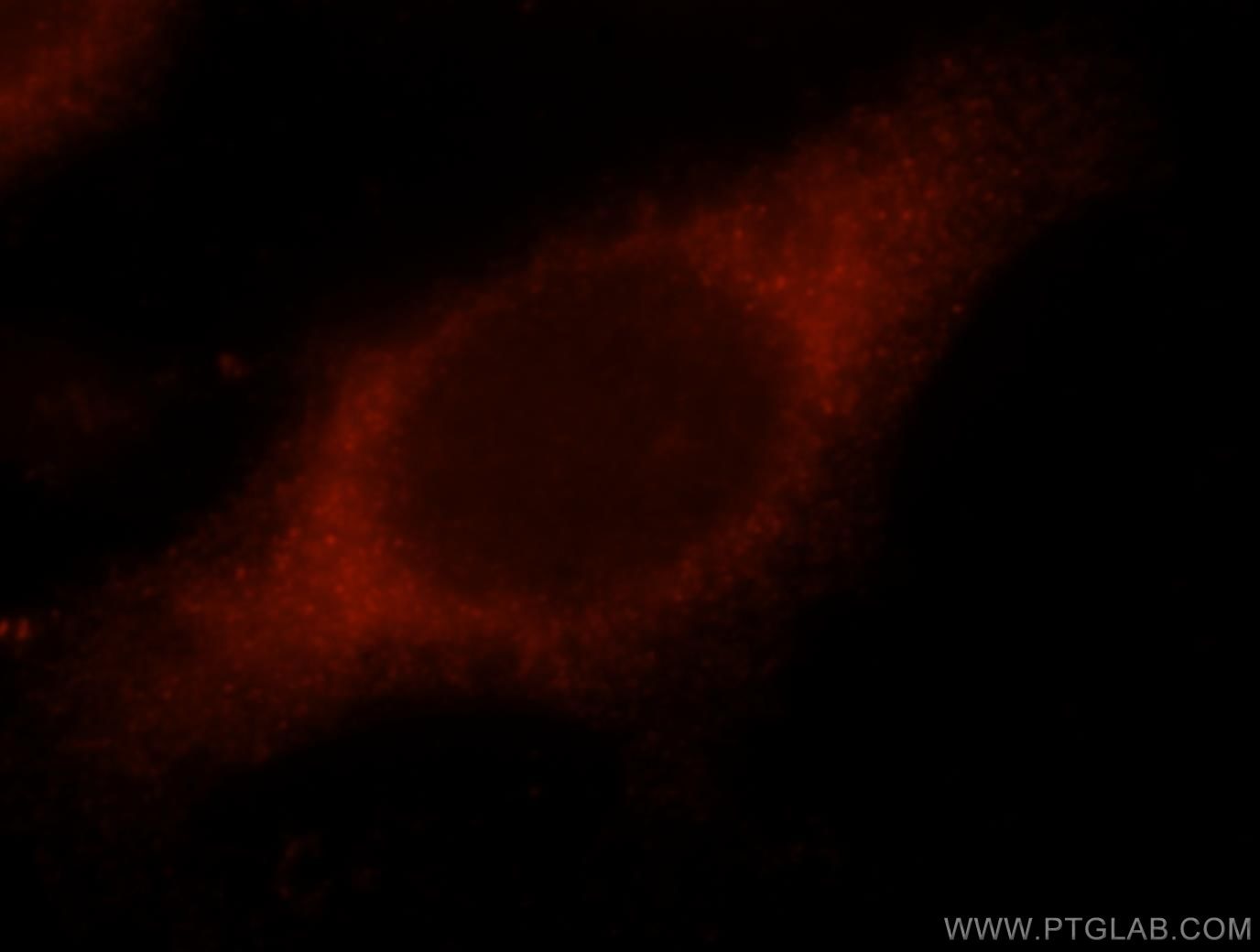 ALIX; AIP1 Immunofluorescence IF 12422-1-AP ALIX; AIP1 Antibody AIP1; Alix; DRIP4; HP95; MGC17003