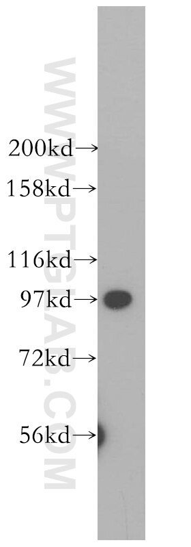 ALIX; AIP1 western blot WB 12422-1-AP ALIX; AIP1 Antibody AIP1; Alix; DRIP4; HP95; MGC17003