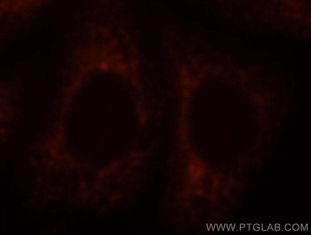 PDIA1 Immunofluorescence IF 11245-1-AP PDIA1 Antibody DSI; ERBA2L; GIT; P4Hbeta; PDI; PDIA1; PHDB; PO4DB; PO4HB; PROHB