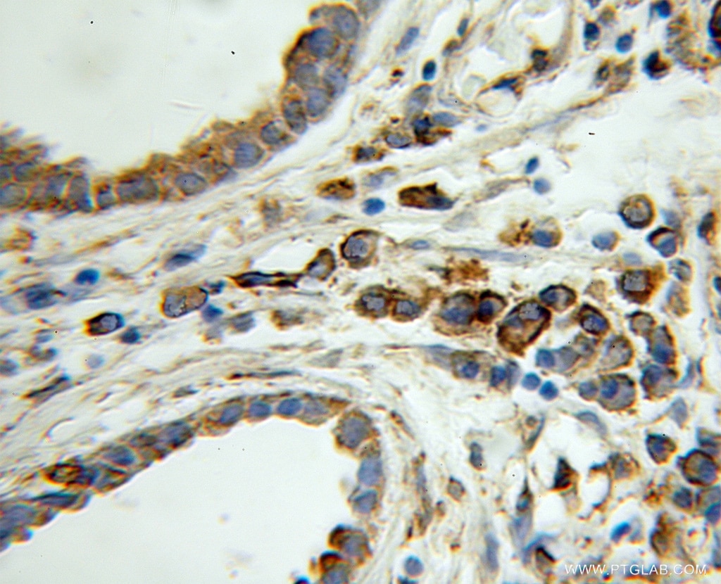 PDIA1 IHC Immunohistochemical 11245-1-AP PDIA1 Antibody DSI; ERBA2L; GIT; P4Hbeta; PDI; PDIA1; PHDB; PO4DB; PO4HB; PROHB