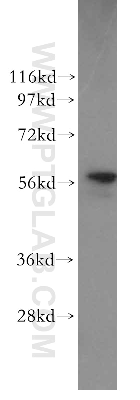 PDIA1 western blot WB 11245-1-AP PDIA1 Antibody DSI; ERBA2L; GIT; P4Hbeta; PDI; PDIA1; PHDB; PO4DB; PO4HB; PROHB