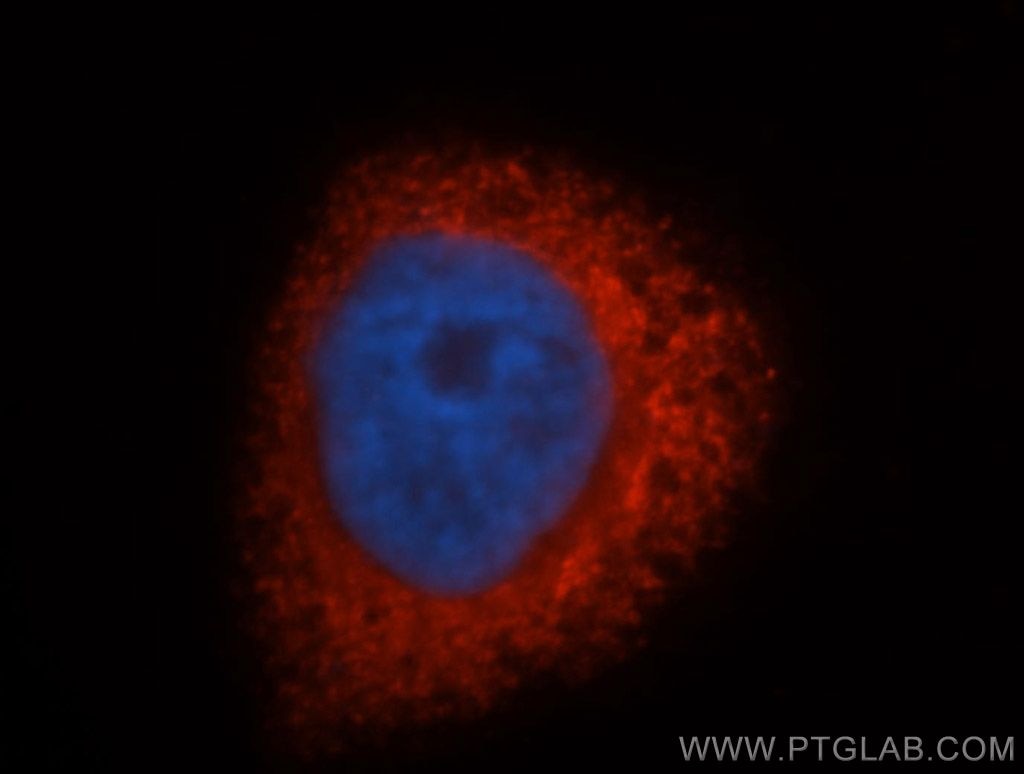PDIA3 Immunofluorescence IF 15967-1-AP PDIA3 Antibody PDIA3;ER60;ERp57;ERp60;ERp61;GRP57;GRP58;HsT17083;P58;PI-PLC ;