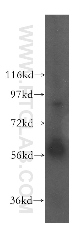 PDIA3 western blot WB 15967-1-AP PDIA3 Antibody PDIA3;ER60;ERp57;ERp60;ERp61;GRP57;GRP58;HsT17083;P58;PI-PLC ;