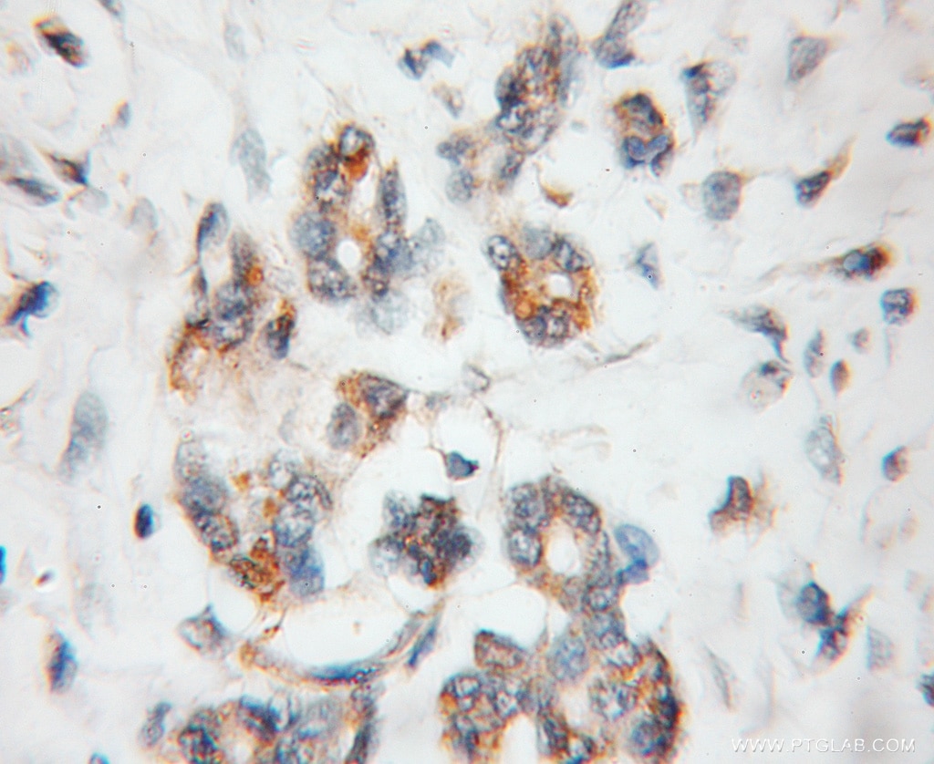 PDLIM1,CLP36 IHC Immunohistochemical 11674-1-AP PDLIM1,CLP36 Antibody CLIM1; CLP-36; CLP36; hCLIM1
