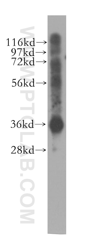 PDLIM1,CLP36 western blot WB 11674-1-AP PDLIM1,CLP36 Antibody CLIM1; CLP-36; CLP36; hCLIM1