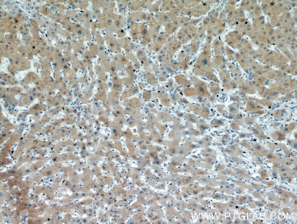 PDXDC1 IHC Immunohistochemical 21021-1-AP PDXDC1 Antibody KIAA0251; LP8165