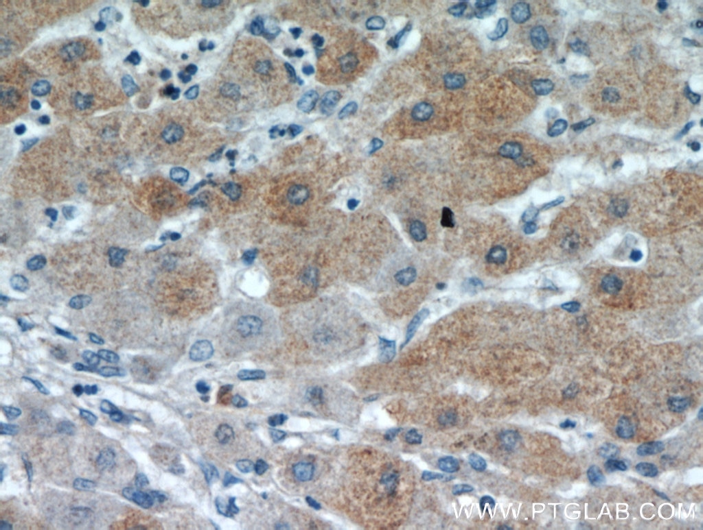 PDXDC1 IHC Immunohistochemical 21021-1-AP PDXDC1 Antibody KIAA0251; LP8165