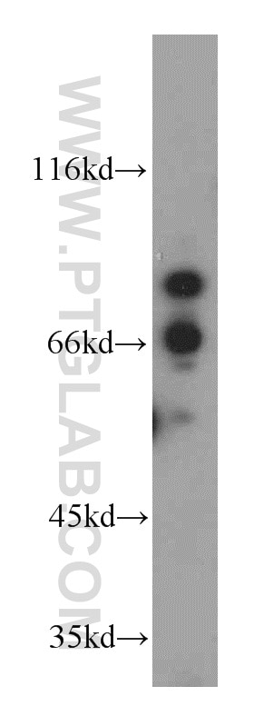 PDXDC1 western blot WB 21021-1-AP PDXDC1 Antibody KIAA0251; LP8165