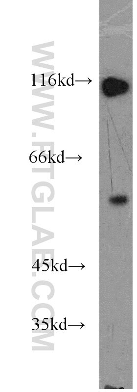 PDZD3 western blot WB 18795-1-AP PDZD3 Antibody FLJ22756; IKEPP; PDZK2