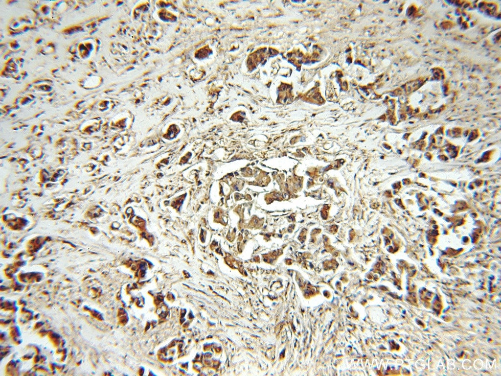 PEG10 IHC Immunohistochemical 14412-1-AP PEG10 Antibody Edr; HB-1; KIAA1051; MEF3L; Mar2; Mart2; RGAG3