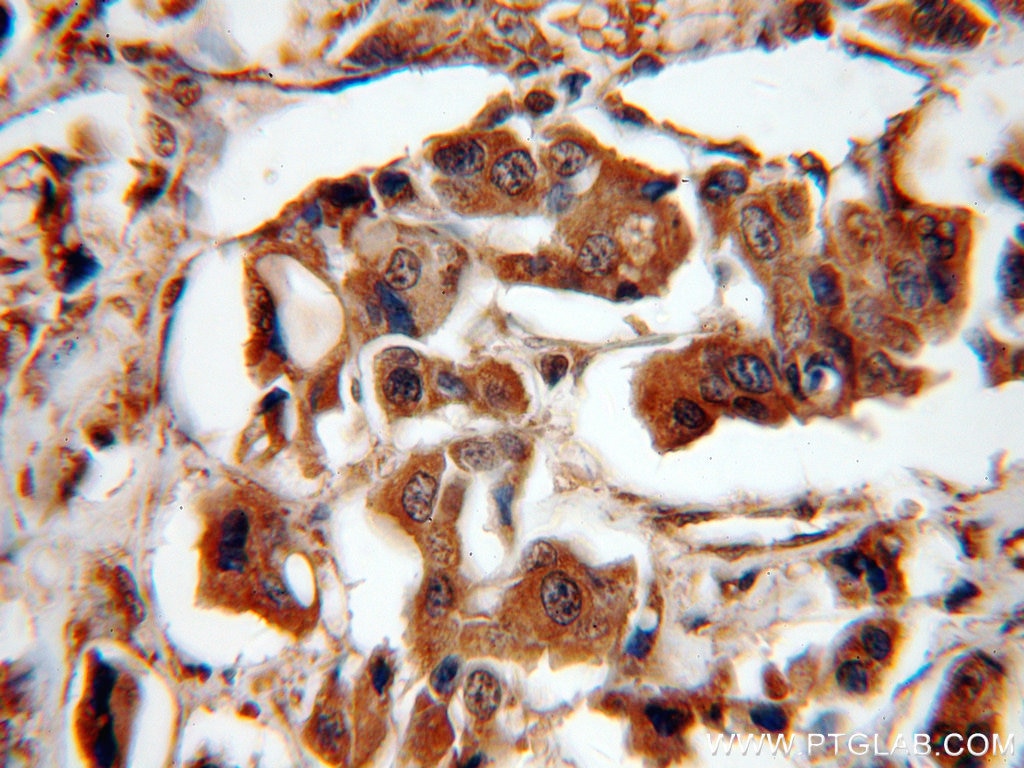 PEG10 IHC Immunohistochemical 14412-1-AP PEG10 Antibody Edr; HB-1; KIAA1051; MEF3L; Mar2; Mart2; RGAG3