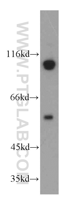 PEG10 western blot WB 14412-1-AP PEG10 Antibody Edr; HB-1; KIAA1051; MEF3L; Mar2; Mart2; RGAG3