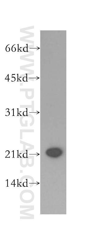 HEK-293 cells were subjected to SDS PAGE followed by western blot with 12990-1-AP(PGRMC1 Antibody) at dilution of 1:1500 PGRMC1 western blot WB 12990-1-AP PGRMC1 Antibody HPR6.6; MPR