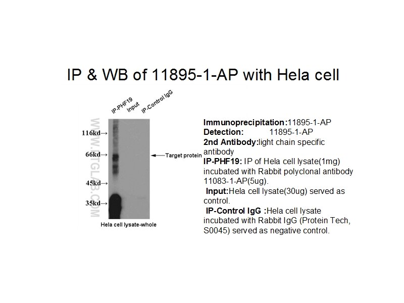 PHF19 IP 11895-1-AP PHF19 Antibody MGC131698; MGC149712; MGC149713; MGC23929; MTF2L1; PCL3