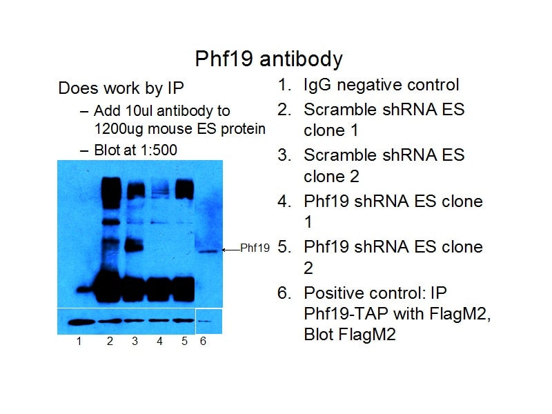 PHF19 IP 11895-1-AP PHF19 Antibody MGC131698; MGC149712; MGC149713; MGC23929; MTF2L1; PCL3