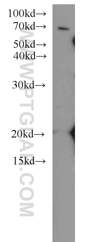 PHF19 western blot WB 11895-1-AP PHF19 Antibody MGC131698; MGC149712; MGC149713; MGC23929; MTF2L1; PCL3