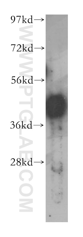 PHF6 western blot WB 51062-1-AP PHF6 Antibody BORJ; MGC14797