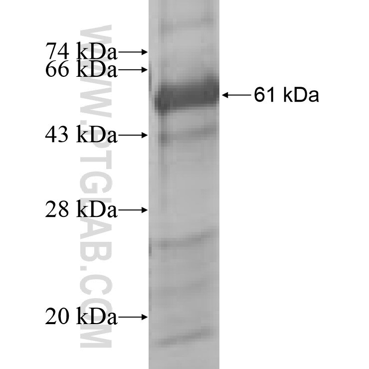 PHF6 fusion protein ag8607 SDS-PAGE