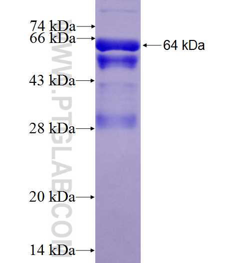 PHGDH fusion protein ag6445 SDS-PAGE