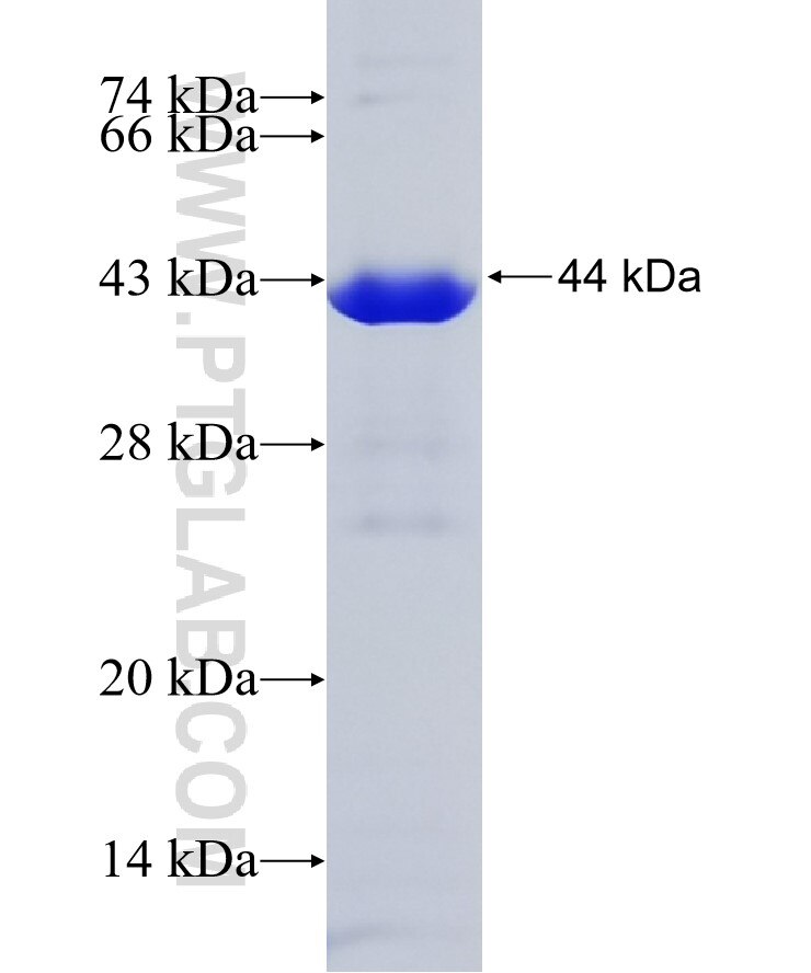 PHGDH fusion protein ag6877 SDS-PAGE