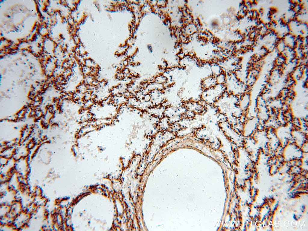 PIH1D1 IHC Immunohistochemical 19427-1-AP PIH1D1 Antibody FLJ20643; NOP17