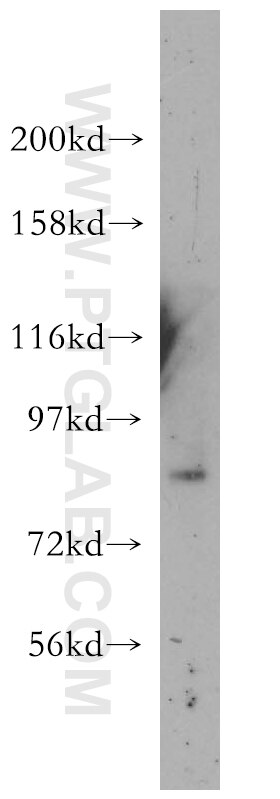 human brain tissue were subjected to SDS PAGE followed by western blot with 11748-1-AP(PIK3R1 Antibody) at dilution of 1:500 PIK3R1 western blot WB 11748-1-AP PIK3R1 Antibody GRB1; p85; p85-ALPHA