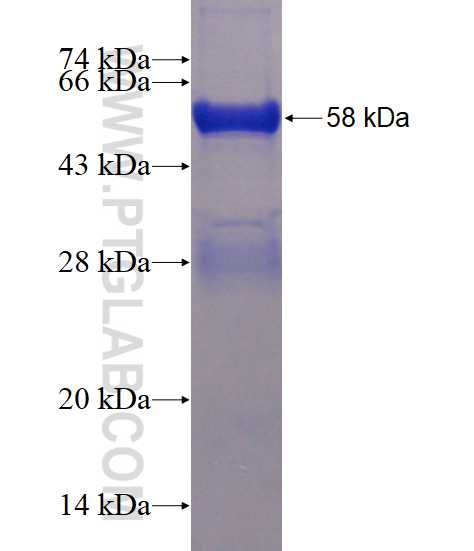 PIP4K2B fusion protein ag4099 SDS-PAGE