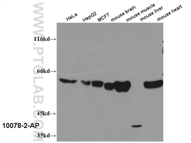 WB result of 10078-2-AP (PKM antibody) with various lysates. PKM WB 10078-2-AP PKM Antibody PK3; PKM; TCB; OIP3; CTHBP; THBP1