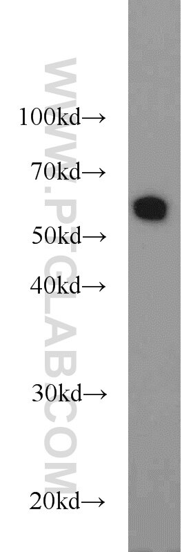 HepG2 cells were subjected to SDS PAGE followed by western blot with 10078-2-AP(PKM Antibody) at dilution of 1:1000 PKM western blot WB 10078-2-AP PKM Antibody PK3; PKM; TCB; OIP3; CTHBP; THBP1