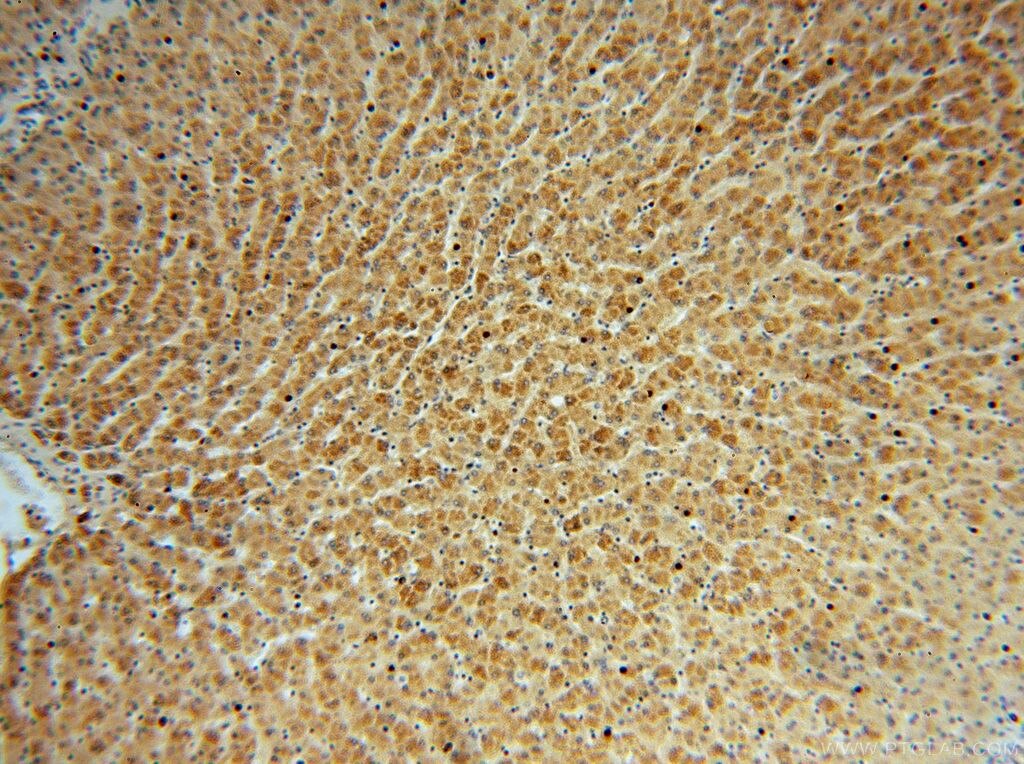 PLG IHC Immunohistochemical 16776-1-AP PLG Antibody DKFZp779M0222