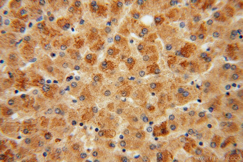 PLG IHC Immunohistochemical 16776-1-AP PLG Antibody DKFZp779M0222