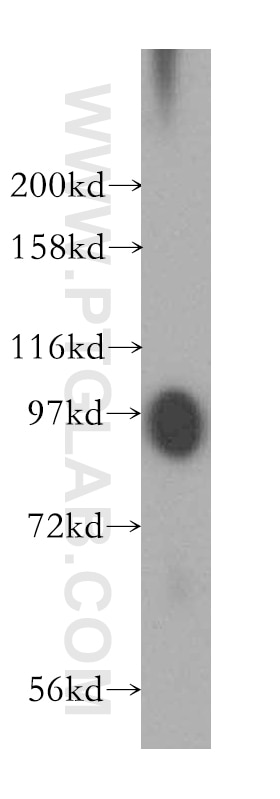 PLG western blot WB 16776-1-AP PLG Antibody DKFZp779M0222