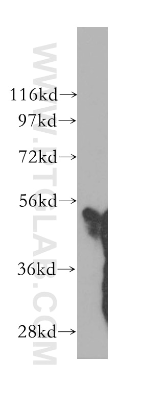 PLXDC2 western blot WB 12285-1-AP PLXDC2 Antibody FLJ14623; TEM7R